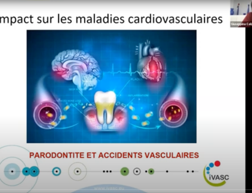 Webinaire: Le bénéfice/risque du traitement parodontal chez les patients avec une maladie cardiovasculaire